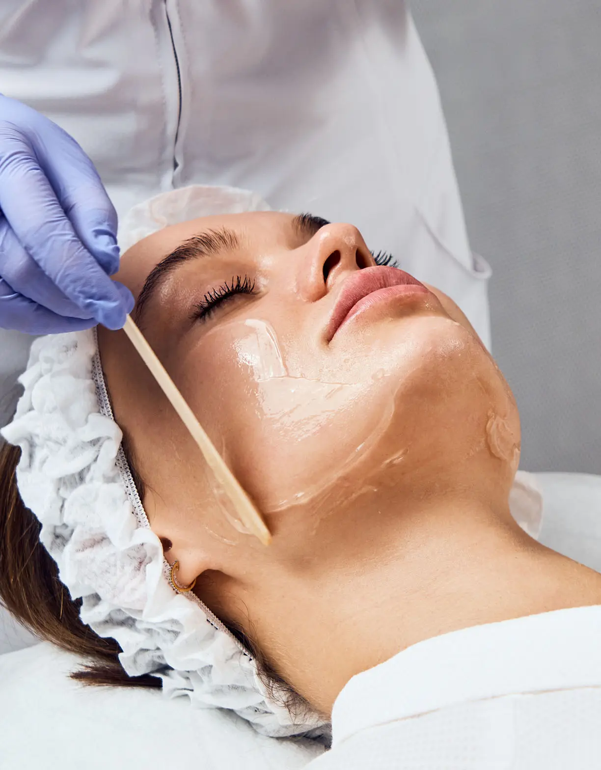 Chemical Peel treatment getting applied to a woman's face | Boise Chemical Peel